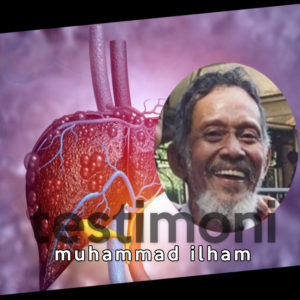 “Liver” Saya Sangat Kenal Dokter Agus